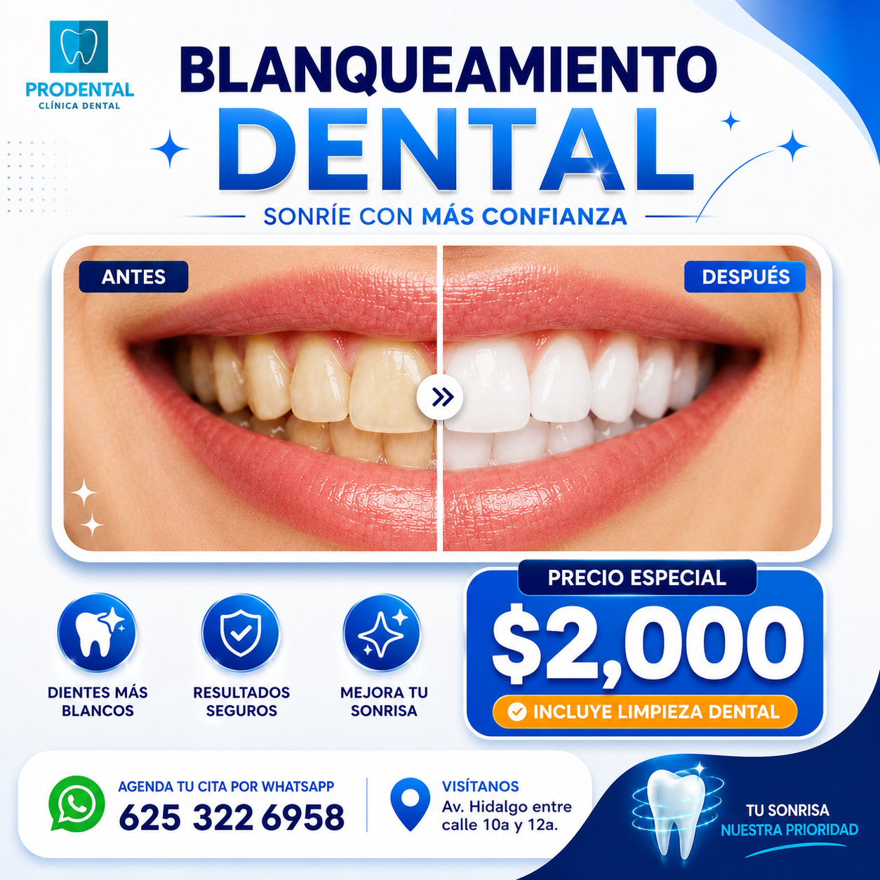 Promoción de blanqueamiento ProDental